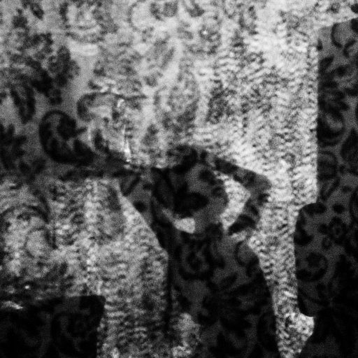 In February, 2015, with a few walls left on the ruins of IBGE building, a young girl is behind a curtain brushing and fixing her hair before going to school. The occupants have to hang curtains or cardboards to maintain their privacy and isolate their homes from other occupants. Only by doing that they can organize private spaces and between the wrecks and garbage in the building's area, try to call it home. A few young girls still go to public schools but the fact that they cannot prove a place of residence and the harsh conditions they live in, local government can take their school vacancy away, as it already happened many times. Mangueira is one of the most famous favelas in Rio de Janeiro for its tradition in samba. It is located in Rio's north zone, a few steps away from Maracana, the biggest football stadium in the city, which received near two billion Reais on public investments for the 2014 World Cup. The misdirection on the government attention, makes the abandoned building, a social disaster as they don't have piped water, collection of garbage or any other public service.